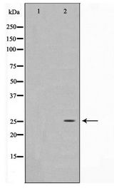 EFNA5 / Ephrin A5 Antibody - Western blot of HeLa cell lysate using EFNA5 Antibody