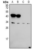 EFNA5 / Ephrin A5 Antibody - Western blot analysis of Ephrin A5 expression in U87MG (A), A549 (B), C6 (C), CT26 (D) whole cell lysates.