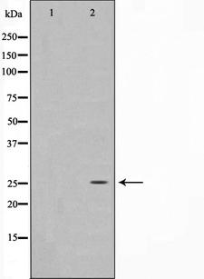 EFNA5 / Ephrin A5 Antibody - Western blot analysis on HeLa cell lysates using EFNA5 antibody. The lane on the left is treated with the antigen-specific peptide.