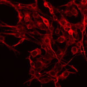 EFNA5 / Ephrin A5 Antibody - Staining HeLa cells by IF/ICC. The samples were fixed with PFA and permeabilized in 0.1% Triton X-100, then blocked in 10% serum for 45 min at 25°C. The primary antibody was diluted at 1:200 and incubated with the sample for 1 hour at 37°C. An Alexa Fluor 594 conjugated goat anti-rabbit IgG (H+L) Ab, diluted at 1/600, was used as the secondary antibody.