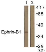 EFNB1 / Ephrin B1 Antibody - Western blot analysis of lysates from COS7 cells, using EFNB1 Antibody. The lane on the right is blocked with the synthesized peptide.