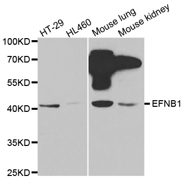 EFNB1 / Ephrin B1 Antibody - Western blot analysis of extracts of various cell lines, using EFNB1 antibody.