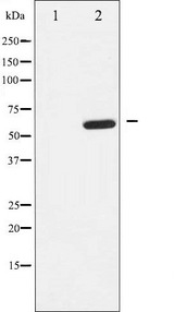 EFNB1 / Ephrin B1 Antibody - Western blot analysis of EFNB1/2 expression in EGF treated 293 whole cells lysates. The lane on the left is treated with the antigen-specific peptide.