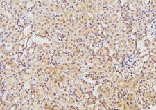 EFNB1 / Ephrin B1 Antibody - 1:100 staining rat kidney tissue by IHC-P. The sample was formaldehyde fixed and a heat mediated antigen retrieval step in citrate buffer was performed. The sample was then blocked and incubated with the antibody for 1.5 hours at 22°C. An HRP conjugated goat anti-rabbit antibody was used as the secondary.