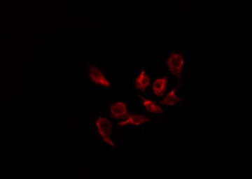 EFNB1 / Ephrin B1 Antibody - Staining 293 cells by IF/ICC. The samples were fixed with PFA and permeabilized in 0.1% Triton X-100, then blocked in 10% serum for 45 min at 25°C. The primary antibody was diluted at 1:200 and incubated with the sample for 1 hour at 37°C. An Alexa Fluor 594 conjugated goat anti-rabbit IgG (H+L) Ab, diluted at 1/600, was used as the secondary antibody.