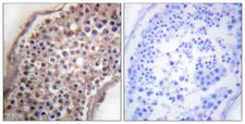 EFNB1 / Ephrin B1 Antibody - Peptide - + Immunohistochemical analysis of paraffin-embedded human testis tissue using Ephrin B (Ab-330) antibody.