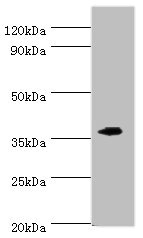 EFNB2 / Ephrin B2 Antibody - Western blot All lanes: EFNB2 antibody at 6µg/ml + Mouse kidney tissue Secondary Goat polyclonal to rabbit IgG at 1/10000 dilution Predicted band size: 37 kDa Observed band size: 37 kDa
