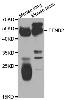 EFNB2 / Ephrin B2 Antibody - Western blot analysis of extracts of various cell lines.