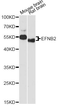 EFNB2 / Ephrin B2 Antibody - Western blot analysis of extracts of various cell lines, using EFNB2 antibody at 1:1000 dilution. The secondary antibody used was an HRP Goat Anti-Rabbit IgG (H+L) at 1:10000 dilution. Lysates were loaded 25ug per lane and 3% nonfat dry milk in TBST was used for blocking. An ECL Kit was used for detection and the exposure time was 90s.
