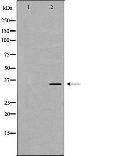 EFNB2 / Ephrin B2 Antibody - Western blot analysis of HeLa whole cells lysates using EFNB2 antibody. The lane on the left is treated with the antigen-specific peptide.