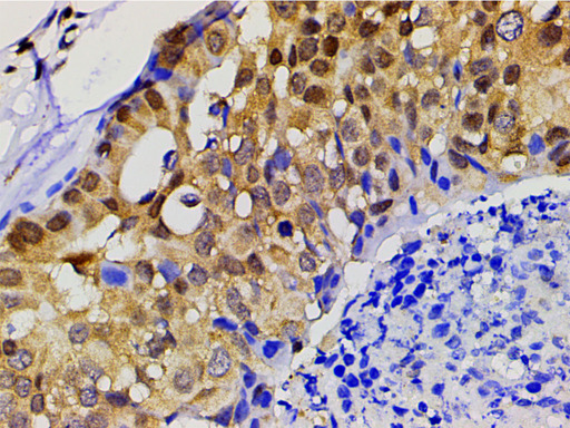 EFNB2 / Ephrin B2 Antibody - 1:200 staining human gastric tissue by IHC-P. The tissue was formaldehyde fixed and a heat mediated antigen retrieval step in citrate buffer was performed. The tissue was then blocked and incubated with the antibody for 1.5 hours at 22°C. An HRP conjugated goat anti-rabbit antibody was used as the secondary.