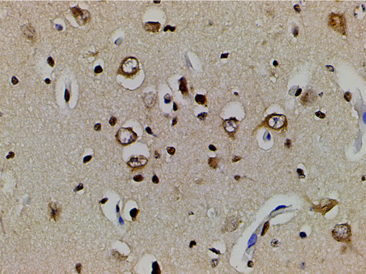 EFNB2 / Ephrin B2 Antibody - 1:200 staining human brain tissue by IHC-P. The tissue was formaldehyde fixed and a heat mediated antigen retrieval step in citrate buffer was performed. The tissue was then blocked and incubated with the antibody for 1.5 hours at 22°C. An HRP conjugated goat anti-rabbit antibody was used as the secondary.