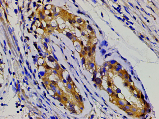 EFNB2 / Ephrin B2 Antibody - 1:200 staining human seminoma tissue by IHC-P. The tissue was formaldehyde fixed and a heat mediated antigen retrieval step in citrate buffer was performed. The tissue was then blocked and incubated with the antibody for 1.5 hours at 22°C. An HRP conjugated goat anti-rabbit antibody was used as the secondary.