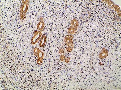 EFNB2 / Ephrin B2 Antibody - 1:100 staining rat uterine tissue by IHC-P. The tissue was formaldehyde fixed and a heat mediated antigen retrieval step in citrate buffer was performed. The tissue was then blocked and incubated with the antibody for 1.5 hours at 22°C. An HRP conjugated goat anti-rabbit antibody was used as the secondary.