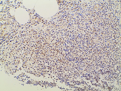 EFNB2 / Ephrin B2 Antibody - 1:100 staining rat appendix tissue by IHC-P. The tissue was formaldehyde fixed and a heat mediated antigen retrieval step in citrate buffer was performed. The tissue was then blocked and incubated with the antibody for 1.5 hours at 22°C. An HRP conjugated goat anti-rabbit antibody was used as the secondary.