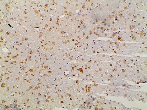 EFNB2 / Ephrin B2 Antibody - 1:100 staining rat brain tissue by IHC-P. The tissue was formaldehyde fixed and a heat mediated antigen retrieval step in citrate buffer was performed. The tissue was then blocked and incubated with the antibody for 1.5 hours at 22°C. An HRP conjugated goat anti-rabbit antibody was used as the secondary.
