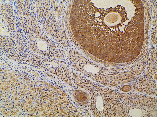 EFNB2 / Ephrin B2 Antibody - 1:100 staining rat ovarian tissue by IHC-P. The tissue was formaldehyde fixed and a heat mediated antigen retrieval step in citrate buffer was performed. The tissue was then blocked and incubated with the antibody for 1.5 hours at 22°C. An HRP conjugated goat anti-rabbit antibody was used as the secondary.