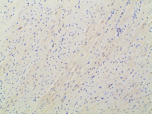 EFNB2 / Ephrin B2 Antibody - 1:100 staining rat heart tissue by IHC-P. The tissue was formaldehyde fixed and a heat mediated antigen retrieval step in citrate buffer was performed. The tissue was then blocked and incubated with the antibody for 1.5 hours at 22°C. An HRP conjugated goat anti-rabbit antibody was used as the secondary.