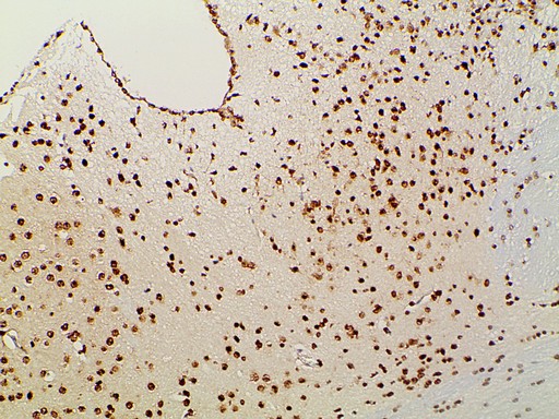 EFNB2 / Ephrin B2 Antibody - 1:100 staining mouse brain tissue by IHC-P. The tissue was formaldehyde fixed and a heat mediated antigen retrieval step in citrate buffer was performed. The tissue was then blocked and incubated with the antibody for 1.5 hours at 22°C. An HRP conjugated goat anti-rabbit antibody was used as the secondary.