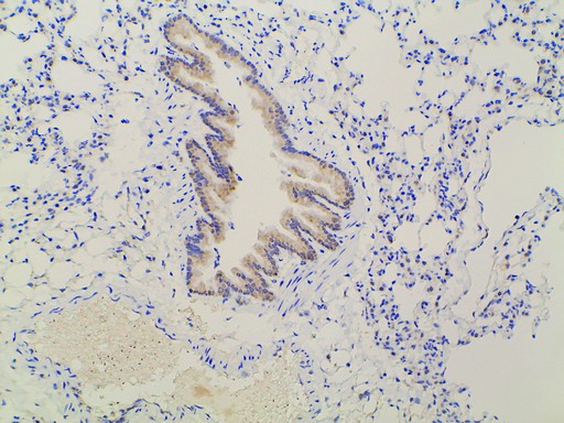 EFNB2 / Ephrin B2 Antibody - 1:100 staining mouse lung tissue by IHC-P. The tissue was formaldehyde fixed and a heat mediated antigen retrieval step in citrate buffer was performed. The tissue was then blocked and incubated with the antibody for 1.5 hours at 22°C. An HRP conjugated goat anti-rabbit antibody was used as the secondary.