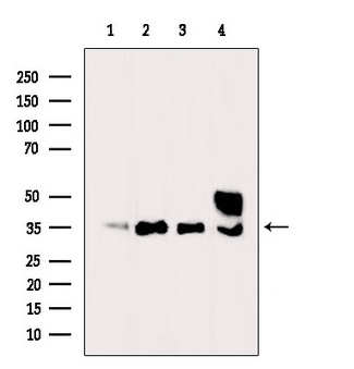EFNB2 / Ephrin B2 Antibody - Western blot analysis of extracts of mouse spleen tissue, rat spleen tissue, HEK293 cells and 293T cells using EFNB2 antibody at 1:1000 dilution.; Lane 1 : mouse spleen tissue; Lane 2 : rat spleen tissue; lane 3 : HEK293 cells extract; lane 4 : 293T cells extract;