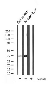 EFNB2 / Ephrin B2 Antibody - Western blot analysis of EFNB2 expression in various lysates