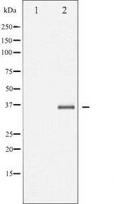 EFNB2 / Ephrin B2 Antibody - Western blot analysis of EFNB1/2 phosphorylation expression in TNF-a treated 293 whole cells lysates. The lane on the left is treated with the antigen-specific peptide.