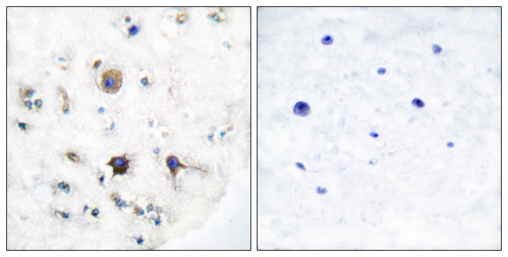 EFNB3 / Ephrin B3 Antibody - Immunohistochemistry analysis of paraffin-embedded human brain tissue, using EFNB3 Antibody. The picture on the right is blocked with the synthesized peptide.