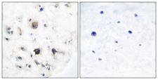 EFNB3 / Ephrin B3 Antibody - Immunohistochemistry analysis of paraffin-embedded human brain tissue, using EFNB3 Antibody. The picture on the right is blocked with the synthesized peptide.