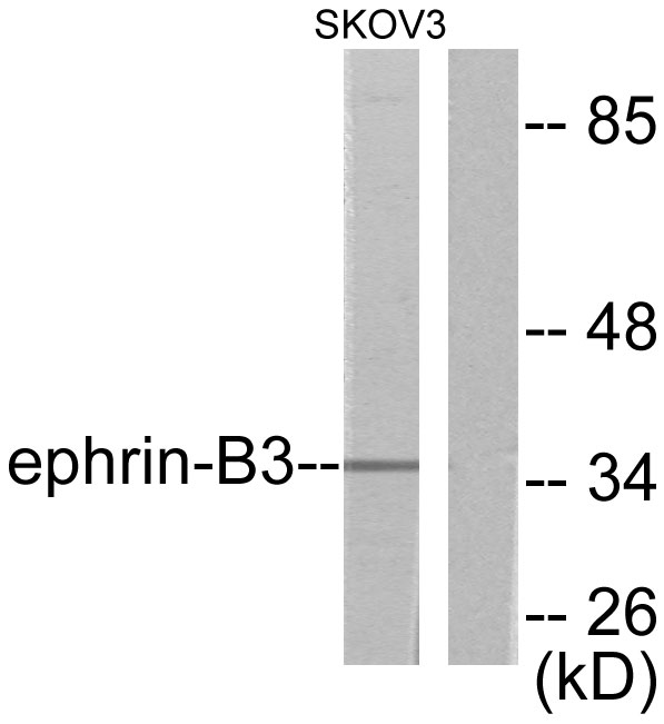 EFNB3 / Ephrin B3 Antibody - Western blot analysis of lysates from SKOV3 cells, using EFNB3 Antibody. The lane on the right is blocked with the synthesized peptide.