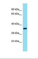 EFNB3 / Ephrin B3 Antibody - Western blot of Mouse Spleen. Efnb3 antibody dilution 1.0 ug/ml.  This image was taken for the unconjugated form of this product. Other forms have not been tested.