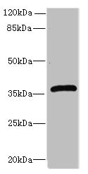 EFNB3 / Ephrin B3 Antibody - Western blot All lanes: Ephrin-B3 antibody at 12µg/ml + HepG2 whole cell lysate Secondary Goat polyclonal to rabbit IgG at 1/10000 dilution Predicted band size: 36 kDa Observed band size: 36 kDa