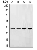 EFNB3 / Ephrin B3 Antibody - Western blot analysis of Ephrin B3 expression in HepG2 (A); NIH3T3 (B); mouse liver (C); rat liver (D) whole cell lysates.