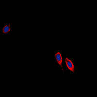 EFNB3 / Ephrin B3 Antibody - Immunofluorescent analysis of Ephrin B3 staining in NIH3T3 cells. Formalin-fixed cells were permeabilized with 0.1% Triton X-100 in TBS for 5-10 minutes and blocked with 3% BSA-PBS for 30 minutes at room temperature. Cells were probed with the primary antibody in 3% BSA-PBS and incubated overnight at 4 C in a humidified chamber. Cells were washed with PBST and incubated with a DyLight 594-conjugated secondary antibody (red) in PBS at room temperature in the dark. DAPI was used to stain the cell nuclei (blue).