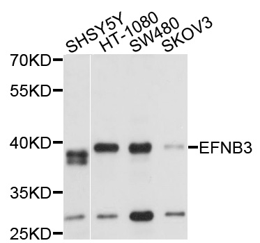EFNB3 / Ephrin B3 Antibody - Western blot analysis of extracts of various cells.