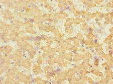 EFNB3 / Ephrin B3 Antibody - Immunohistochemistry of paraffin-embedded human liver tissue at dilution 1:100