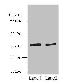 EFNB3 / Ephrin B3 Antibody - Western blot All Lanes: EFNB3 antibody at 1.44ug/ml Lane 1: HepG-2 whole cell lysate Lane 2: Hela whole cell lysate Secondary Goat polyclonal to rabbit IgG at 1/10000 dilution Predicted band size: 36 kDa Observed band size: 36 kDa