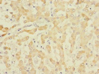 EFNB3 / Ephrin B3 Antibody - Immunohistochemistry of paraffin-embedded human liver tissue at dilution 1:100
