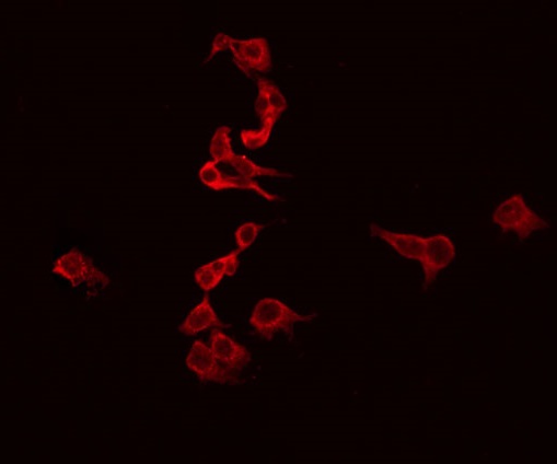 EFNB3 / Ephrin B3 Antibody - Staining SK-OV3 cells by IF/ICC. The samples were fixed with PFA and permeabilized in 0.1% Triton X-100, then blocked in 10% serum for 45 min at 25°C. The primary antibody was diluted at 1:200 and incubated with the sample for 1 hour at 37°C. An Alexa Fluor 594 conjugated goat anti-rabbit IgG (H+L) Ab, diluted at 1/600, was used as the secondary antibody.