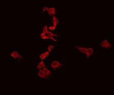 EFNB3 / Ephrin B3 Antibody - Staining SK-OV3 cells by IF/ICC. The samples were fixed with PFA and permeabilized in 0.1% Triton X-100, then blocked in 10% serum for 45 min at 25°C. The primary antibody was diluted at 1:200 and incubated with the sample for 1 hour at 37°C. An Alexa Fluor 594 conjugated goat anti-rabbit IgG (H+L) Ab, diluted at 1/600, was used as the secondary antibody.