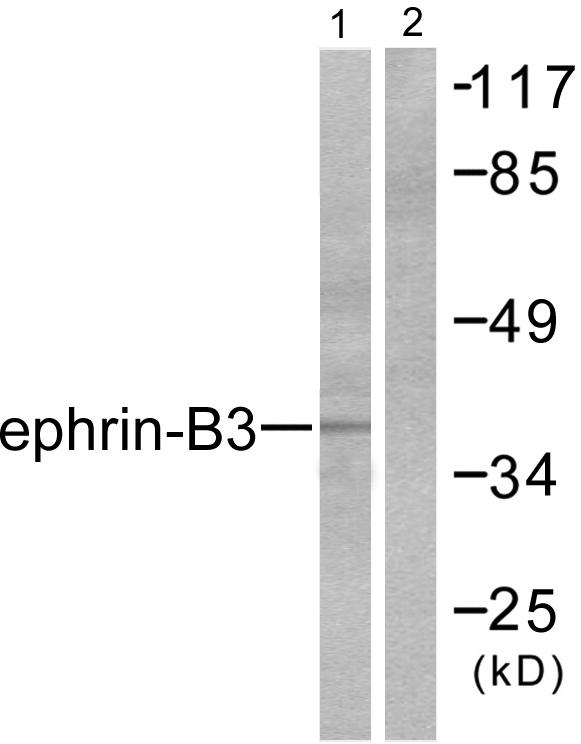 EFNB3 / Ephrin B3 Antibody - Western blot analysis of extracts from SKOV3 cells, using Ephrin-B3 antibody.
