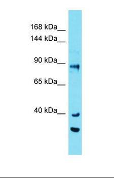 EFR3A Antibody - Western blot of Human COLO205. EFR3A antibody dilution 1.0 ug/ml.  This image was taken for the unconjugated form of this product. Other forms have not been tested.