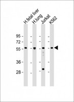 EFS / CASS3 Antibody - All lanes: Anti-EFS Antibody (Center) at 1:1000-1:2000 dilution. Lane 1: human fetal liver lysate. Lane 2: human lung lysate. Lane 3: Jurkat whole cell lysate. Lane 4: K562 whole cell lysate Lysates/proteins at 20 ug per lane. Secondary Goat Anti-Rabbit IgG, (H+L), Peroxidase conjugated at 1:10000 dilution. Predicted band size: 59 kDa. Blocking/Dilution buffer: 5% NFDM/TBST.