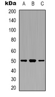 EFTU / TUFM Antibody - Western blot analysis of TUFM expression in H1299 (A); A431 (B); NIH3T3 (C) whole cell lysates.