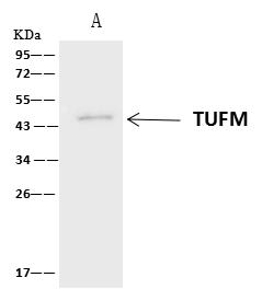 EFTU / TUFM Antibody - TUFM was immunoprecipitated using: Lane A: 0.5 mg HepG2 Whole Cell Lysate. 4 uL anti-TUFM rabbit polyclonal antibody and 60 ug of Immunomagnetic beads Protein A/G. Primary antibody: Anti-TUFM rabbit polyclonal antibody, at 1:100 dilution. Secondary antibody: Clean-Blot IP Detection Reagent (HRP) at 1:1000 dilution. Developed using the ECL technique. Performed under reducing conditions. Predicted band size: 50 kDa. Observed band size: 50 kDa.