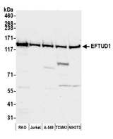 EFTUD1 Antibody - Detection of human and mouse EFTUD1 by western blot. Samples: Whole cell lysate (50 µg) from RKO, Jurkat, A-549, mouse TCMK-1, and mouse NIH 3T3 cells prepared using NETN lysis buffer. Antibody: Affinity purified rabbit anti-EFTUD1 antibody used for WB at 1:1000. Detection: Chemiluminescence with an exposure time of 30 seconds.