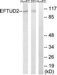 EFTUD2 Antibody - Western blot of extracts from 293/HUVEC cells, using EFTUD2 Antibody. The lane on the right is treated with the synthesized peptide.