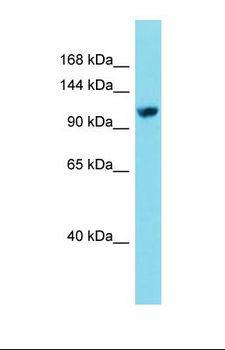 EFTUD2 Antibody - Western blot of Jurkat. EFTUD2 antibody dilution 1.0 ug/ml.  This image was taken for the unconjugated form of this product. Other forms have not been tested.