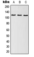 EFTUD2 Antibody - Western blot analysis of SNRP116 expression in HeLa (A); NIH3T3 (B); H9C2 (C) whole cell lysates.