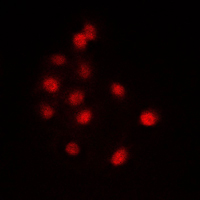 EFTUD2 Antibody - Immunofluorescent analysis of SNRP116 staining in NIH3T3 cells. Formalin-fixed cells were permeabilized with 0.1% Triton X-100 in TBS for 5-10 minutes and blocked with 3% BSA-PBS for 30 minutes at room temperature. Cells were probed with the primary antibody in 3% BSA-PBS and incubated overnight at 4 C in a humidified chamber. Cells were washed with PBST and incubated with a DyLight 594-conjugated secondary antibody (red) in PBS at room temperature in the dark. DAPI was used to stain the cell nuclei (blue).